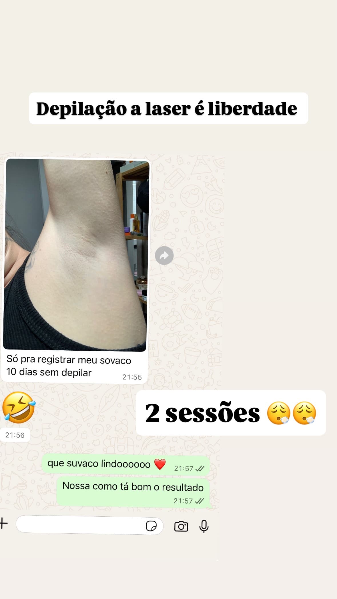 Depilação a laser
